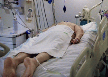 “Kthejini përmbys pacientët”, mjekja zbulon metodën e thjeshtë që po shpëton jetë