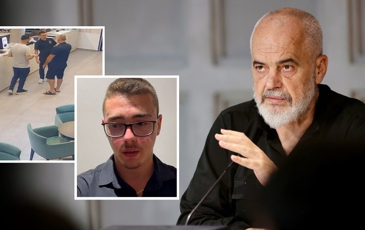 “Konflikt i shëmtuar në Vlorë”, Rama: Sapo të dalë nga spitali, të përjashtohet pa kthim efektivi i policisë që u përfshi. T’i dorëzohet drejtësisë!